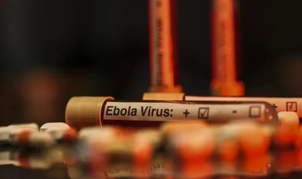 ABD'den Ebola uyarısı: Tarihin en ölümcül seviyesine ulaşabilir