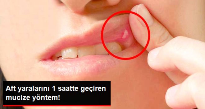 AFT YARALARINI 1 SAAT İÇERİSİNDE GEÇİREN YÖNTEM