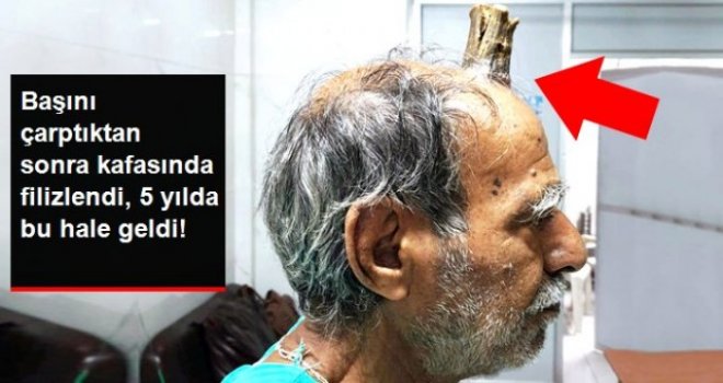 Başını çarptıktan sonra filizlendi