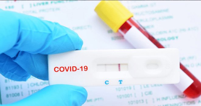 Covid-19 test fiyatı 50 Euro'ya düştü