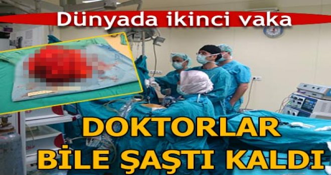 Dünyada ikinci kez rastlanan vaka doktorları bile şaşırttı