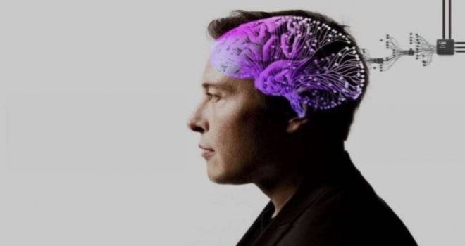 Elon Musk, beyin çipi deneyinin ilk sonuçlarını paylaştı