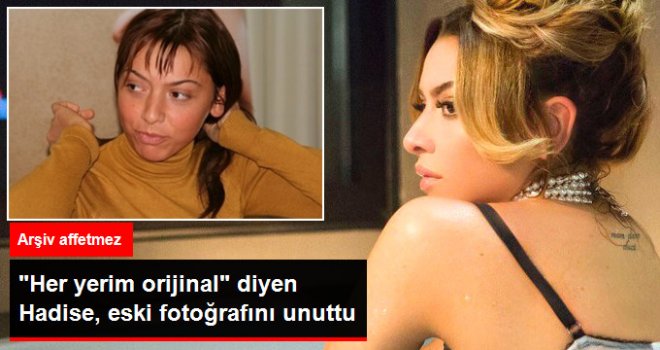 Eski Fotoğraflarını Unutan Hadise "Her Yerim Orijinal" Dedi