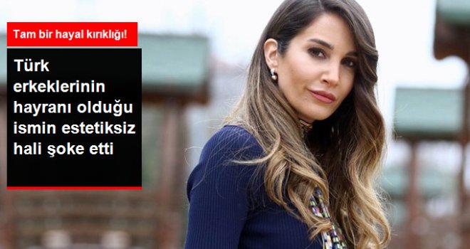 Estetiksiz Halini Gören Gözlerine İnanamıyor