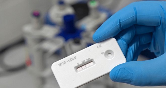 Güneyde açılımın ilk aşaması için 20 bin test sipariş edildi