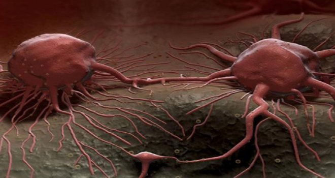 IRAK'TAKİ KANSER VAKALARINDA ARTIŞ