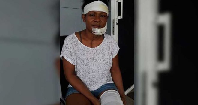 Kadın spor yıldızına erkek şiddeti