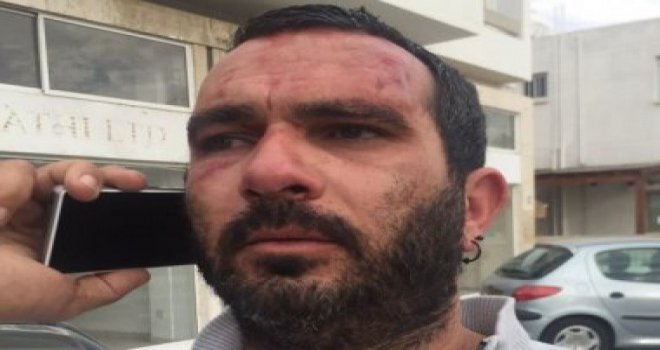 Kıbrıslı Türk taksici'ye saldıran Kıbrıslı Rumlardan ikincisinin de gözaltına alındı