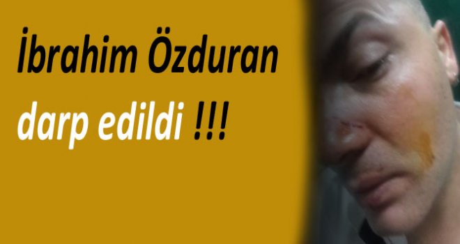 KKTC'nin sevilen ses sanatçılardan olan İbrahim Özduran dün gece darp edildi.