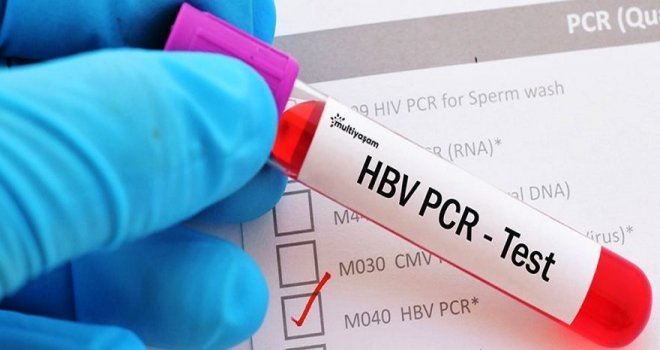 PCR testi ücreti 300 TL