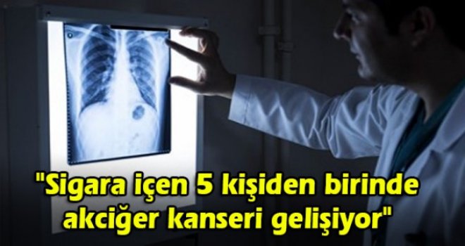 Sigara içen 5 kişiden birinde akciğer kanseri gelişiyor