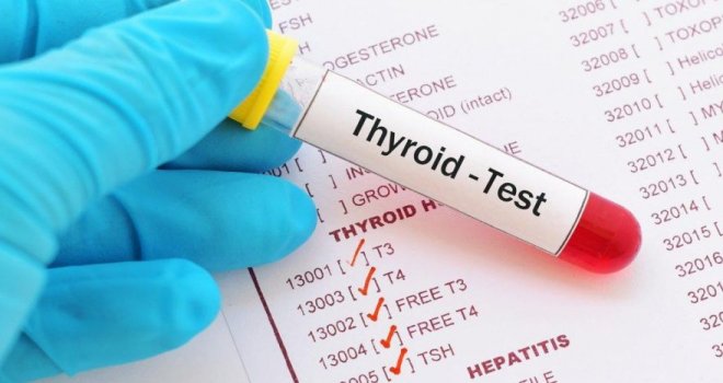 T3-T4 tiroid fonksiyon testleri nedir?